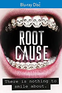 Root Cause